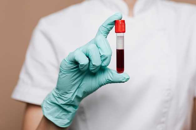 Как и когда анализировать кровь на ХГЧ