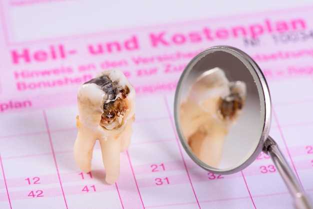 Симптомы и причины развития кариеса на корне зуба
