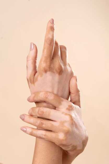 Причины отшелушивания кожи на руках