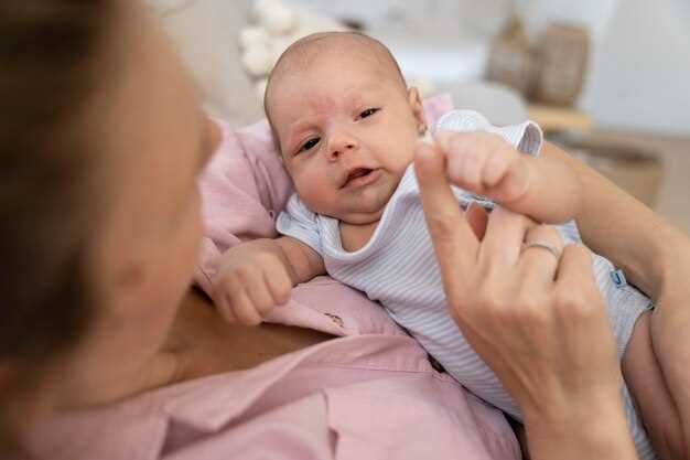 Избавление от белого налета на губах у новорожденного