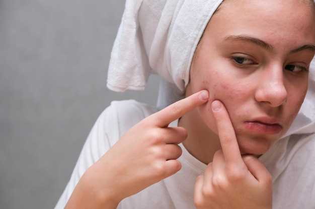 Эффективные методы лечения стафилококка на лице