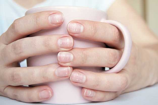 Причины проблемы обгрызенных ногтей