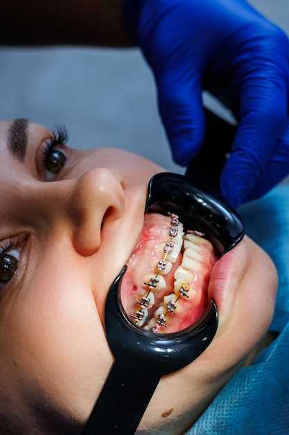 Методы лечения пародонтоза в современной стоматологии